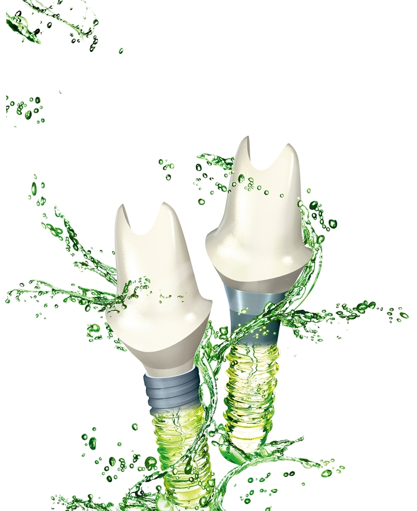 스트라우만, 독일 허위 과장 광고 소송 승리 < 의료기기·IT < 기사본문 - 메드월드뉴스