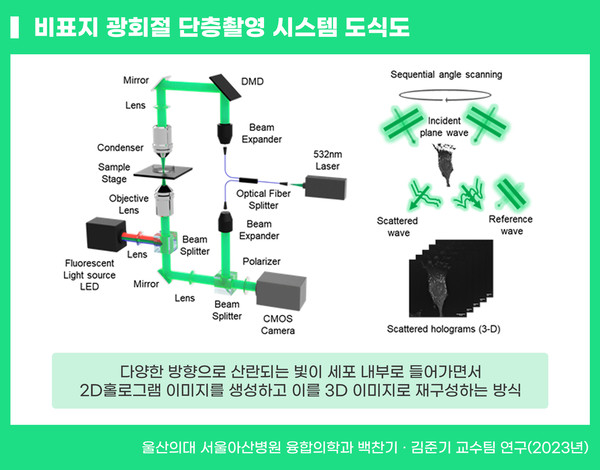 비표지 광회절 단층촬영 시스템/ 자료=서울아산병원