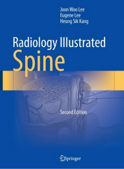 Radiology Illustrated: Spine 2판