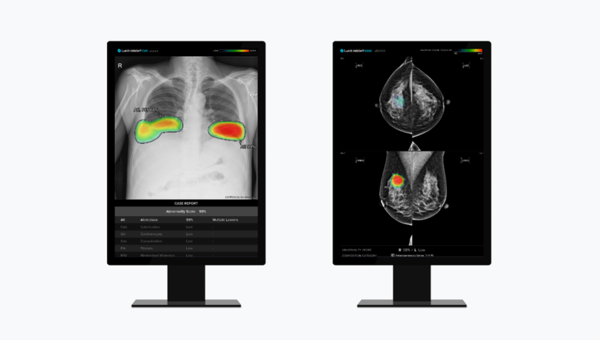 루닛 흉부 엑스레이 AI 영상분석 솔루션 '루닛 인사이트 CXR'(왼쪽) 및 유방촬영술 AI 영상분석 솔루션 '루닛 인사이트 MMG' (사진제공=루닛)