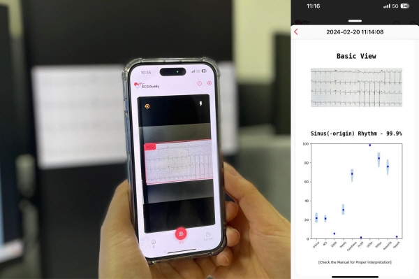 의료인공지능 ‘ECG Buddy’ 구동 예시. 별도의 장비 없이 심전도 검사 결과 이미지를 스마트폰으로 촬영(왼쪽)하면 인공지능모델이 이를 분석해 응급질환 판단을 지원(오른쪽)한다.
