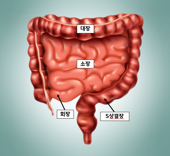 국내 첫 말기암 환자 ‘초음파내시경 유도하 회장결장연결술’ 성공